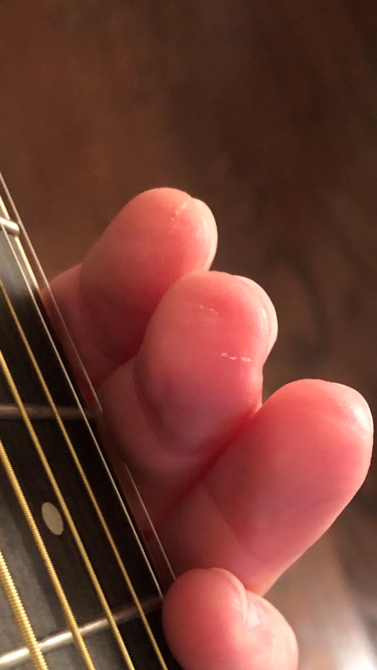 Vangoa 3/4 Acoustic Guitar Beginner Kit Spruce Top for Youth, Glossy Finish customer photo 1